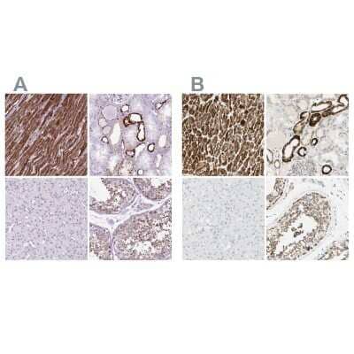 Immunohistochemistry-Paraffin: OXCT1 Antibody [NBP2-49331]