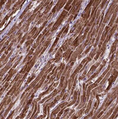 Immunohistochemistry-Paraffin: OXCT1 Antibody [NBP2-49331]