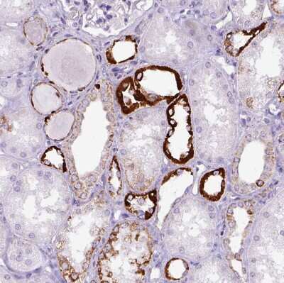 Immunohistochemistry-Paraffin: OXCT1 Antibody [NBP2-49331]