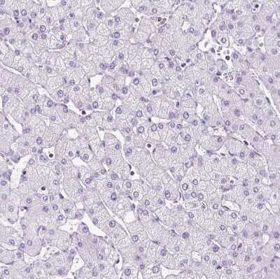Immunohistochemistry-Paraffin: OXCT1 Antibody [NBP2-49331]
