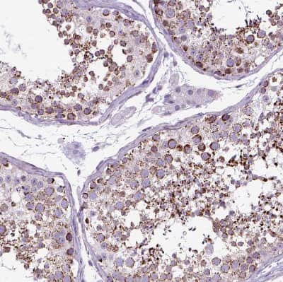 Immunohistochemistry-Paraffin: OXCT1 Antibody [NBP2-49331]