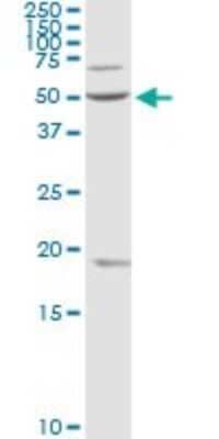 Western Blot: OXCT1 Antibody [H00005019-D01P]