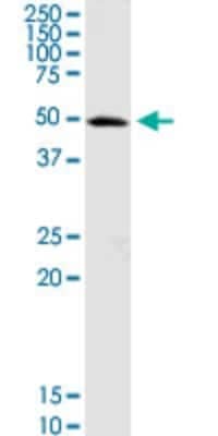 Western Blot: OXCT1 Antibody [H00005019-D01P]