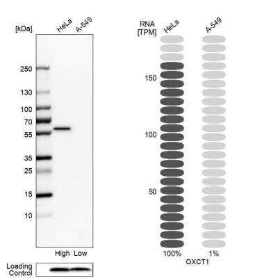 Western Blot: OXCT1 Antibody [NBP1-82462]