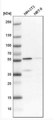 Western Blot: OXCT1 Antibody [NBP1-82462]