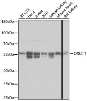 Western Blot: OXCT1 AntibodyBSA Free [NBP3-03623]