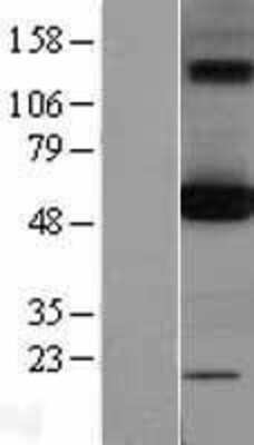 Western Blot: OXCT1 Overexpression Lysate [NBL1-14018]