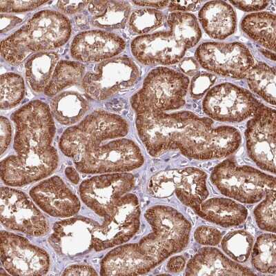 Immunohistochemistry: OXER1/5-oxo-ETE GPCR Antibody [NBP2-49006]