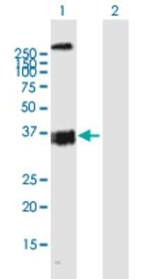 Western Blot: OXER1/5-oxo-ETE GPCR Antibody [H00165140-B01P]