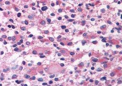 Immunohistochemistry-Paraffin: OXGR1/GPR80/P2Y15 Antibody - BSA Free [NLS6747]