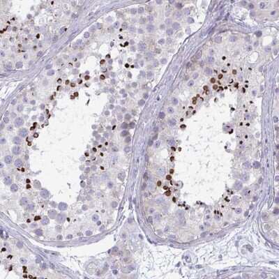 Immunohistochemistry: OXLD1 Antibody [NBP2-31653]
