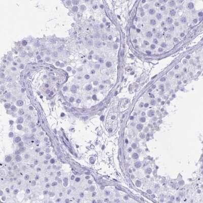 Immunohistochemistry-Paraffin: OXLD1 Antibody [NBP2-31657]