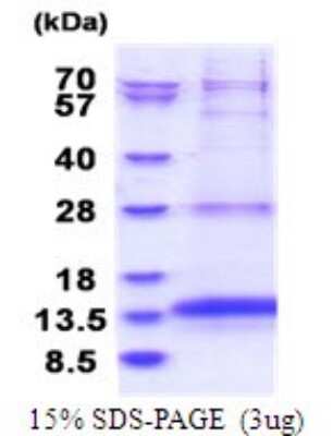 SDS-PAGE: Recombinant Human OXLD1 His Protein [NBP2-51749]