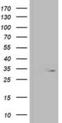 Western Blot: OXNAD1 Antibody (OTI1D1) [NBP2-00916]