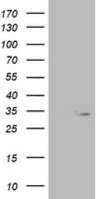 Western Blot: OXNAD1 Antibody (OTI1D1)Azide and BSA Free [NBP2-73175]