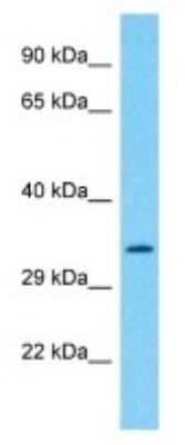 Western Blot: OXNAD1 Antibody [NBP3-09874]