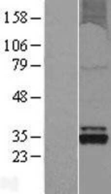 Western Blot: OXNAD1 Overexpression Lysate [NBL1-14022]