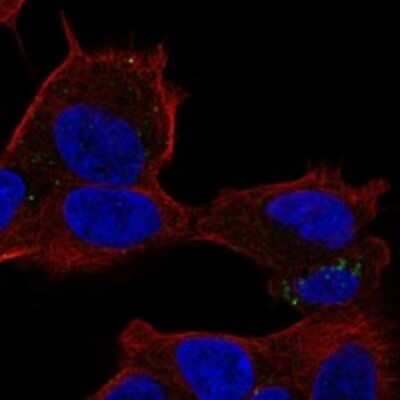 Immunocytochemistry/ Immunofluorescence: OXPAT Antibody [NBP3-17192]