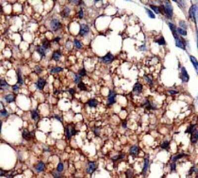 Immunohistochemistry: OXPAT Antibody - BSA Free [NB110-60509]