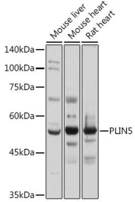 Western Blot: OXPAT AntibodyAzide and BSA Free [NBP3-16013]