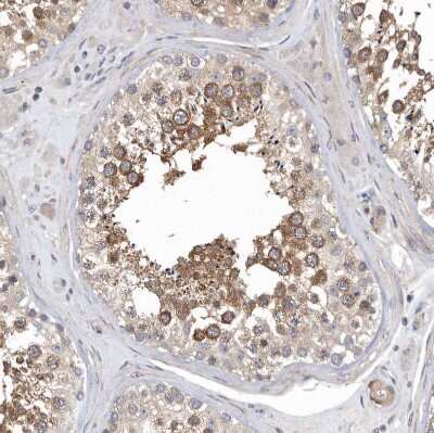 Immunohistochemistry-Paraffin: OXR1 Antibody [NBP1-86391]
