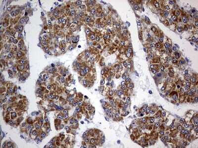 Immunohistochemistry: OXSM Antibody (OTI4E10) [NBP2-46304]