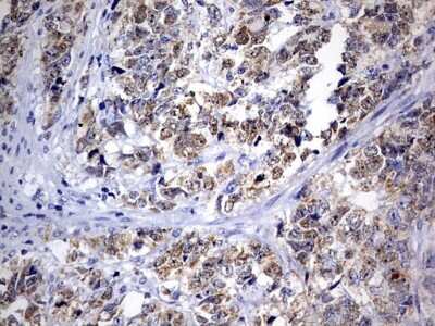 Immunohistochemistry: OXSM Antibody (OTI4E10) [NBP2-46304]
