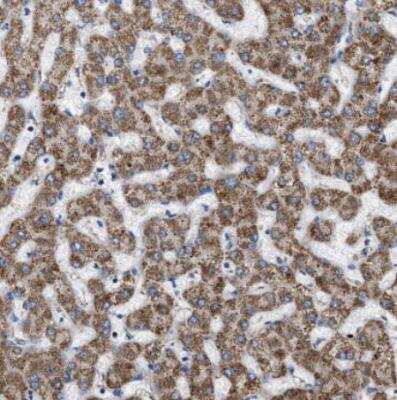 Immunohistochemistry-Paraffin: OXSM Antibody [NBP1-84730]