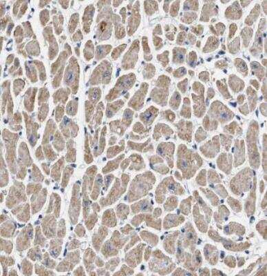 Immunohistochemistry-Paraffin: OXSM Antibody [NBP1-84730]