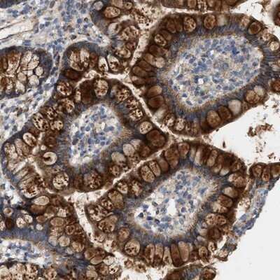 Immunohistochemistry-Paraffin: OXSM Antibody [NBP1-84731]