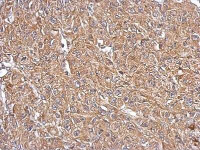 Immunohistochemistry-Paraffin: OXSM Antibody [NBP2-19647]