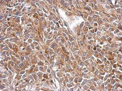 Immunohistochemistry-Paraffin: OXSM Antibody [NBP2-19647]