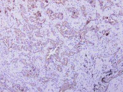Immunohistochemistry-Paraffin: OXSM Antibody [NBP2-19647]