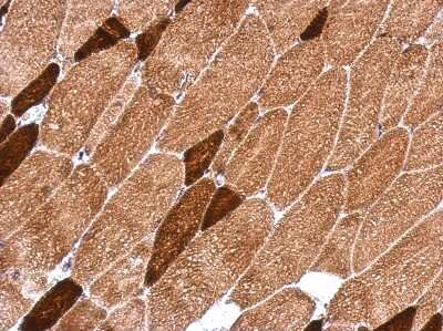 Immunohistochemistry-Paraffin: OXSM Antibody [NBP2-19648]