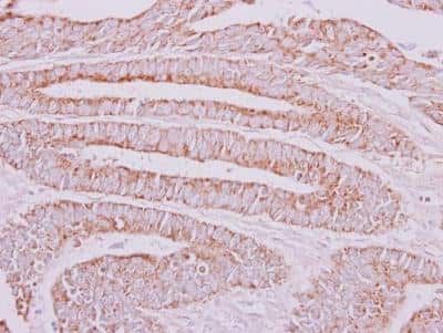 Immunohistochemistry-Paraffin: OXSM Antibody [NBP2-19648]