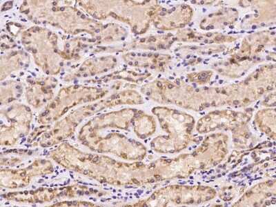 Immunohistochemistry-Paraffin: OXSM Antibody [NBP2-97290]