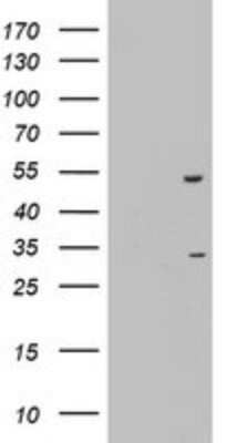 Western Blot: OXSM Antibody (OTI4E10)Azide and BSA Free [NBP2-73176]