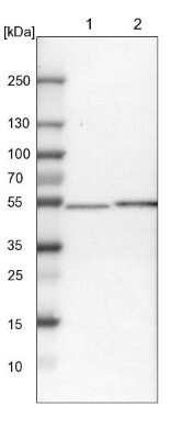 Western Blot: OXSM Antibody [NBP1-84732]