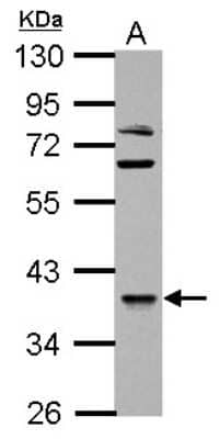 Western Blot: OXSM Antibody [NBP2-19649]