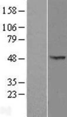 Western Blot: OXSM Overexpression Lysate [NBL1-14024]