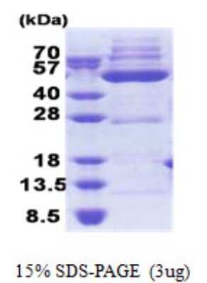 SDS-PAGE: Recombinant Human OXSM His Protein [NBP2-22661]