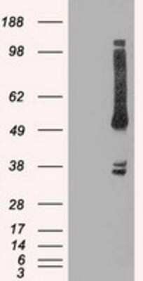 Western Blot: OXSR1 Antibody (OTI1F3) [NBP1-47905]