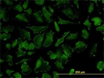 Immunocytochemistry/ Immunofluorescence: OXSR1 Antibody (2A2-1A2) [H00009943-M01]