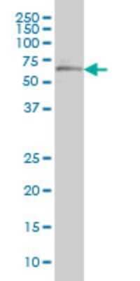 Western Blot: OXSR1 Antibody (2A2-1A2) [H00009943-M01]