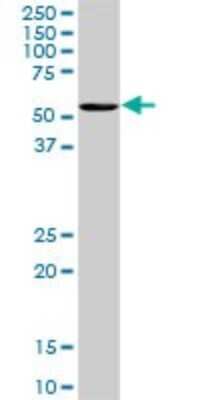 Western Blot: OXSR1 Antibody (2A5) [H00009943-M20]