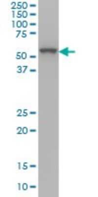 Western Blot: OXSR1 Antibody (2A5) [H00009943-M20]