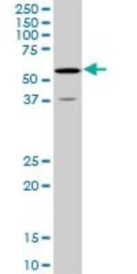 Western Blot: OXSR1 Antibody (2A5) [H00009943-M20]