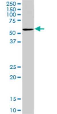 Western Blot: OXSR1 Antibody (2A5) [H00009943-M20]