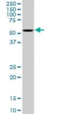 Western Blot: OXSR1 Antibody (3A8) [H00009943-M16]