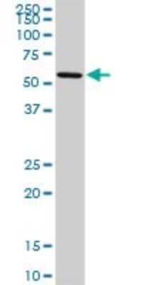 Western Blot: OXSR1 Antibody (3A8) [H00009943-M16]